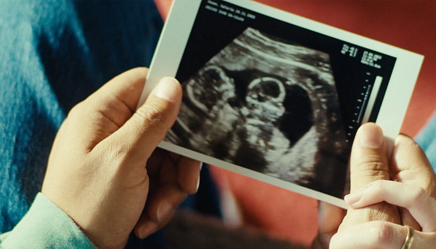 Pregnancy ultrasound scanning photo