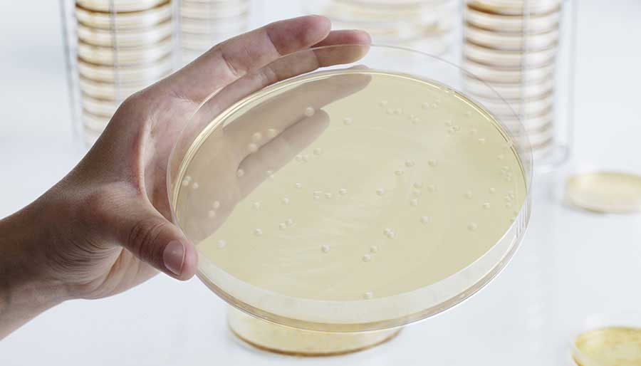 Petri dish in hand