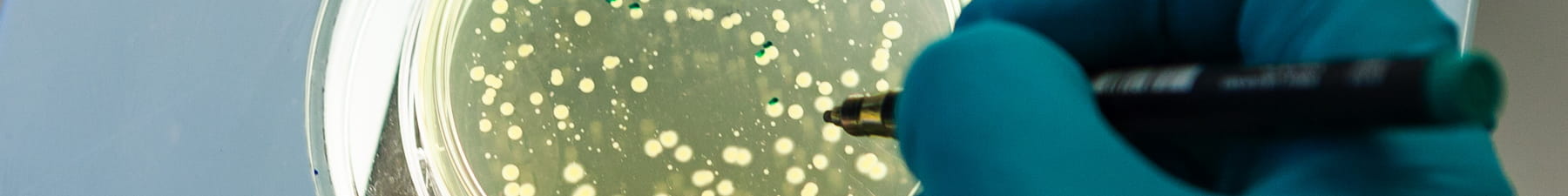 Petri dish plant health